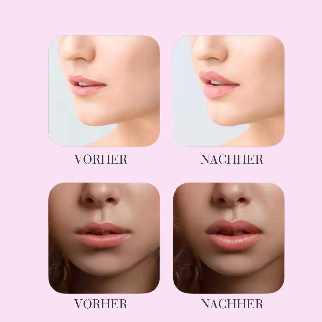 Lip Enhancer "Volumizer"